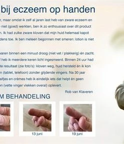 Nieuw 🔔 Gloves In A Bottle (GIAB) | Beschermende, Hydraterende En Herstellende Lotion | Eczeem, Droge Huid, Psoriasis |Starter Kit 240 Ml + 60 Ml 👍 -Oral-B Shop 550x287