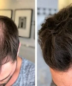 Beste deal π IMPERIO Premium Haarvezels Donkerbruin - Kaalheid Mannen - Alopecia Vrouwen - 100% Onzichtbaar π 39 Beste deal π IMPERIO Premium Haarvezels Donkerbruin - Kaalheid Mannen - Alopecia Vrouwen - 100% Onzichtbaar π -Oral-B Shop 550x297