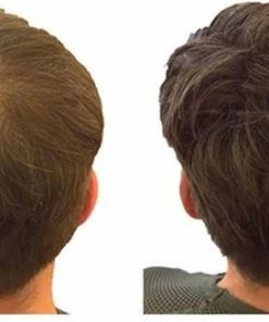 Beste deal π IMPERIO Premium Haarvezels Donkerbruin - Kaalheid Mannen - Alopecia Vrouwen - 100% Onzichtbaar π 38 Beste deal π IMPERIO Premium Haarvezels Donkerbruin - Kaalheid Mannen - Alopecia Vrouwen - 100% Onzichtbaar π -Oral-B Shop 550x326