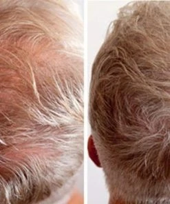 Beste deal π IMPERIO Premium Haarvezels Donkerbruin - Kaalheid Mannen - Alopecia Vrouwen - 100% Onzichtbaar π 41 Beste deal π IMPERIO Premium Haarvezels Donkerbruin - Kaalheid Mannen - Alopecia Vrouwen - 100% Onzichtbaar π -Oral-B Shop 550x363