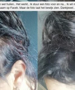 Beste deal π IMPERIO Premium Haarvezels Donkerbruin - Kaalheid Mannen - Alopecia Vrouwen - 100% Onzichtbaar π 33 Beste deal π IMPERIO Premium Haarvezels Donkerbruin - Kaalheid Mannen - Alopecia Vrouwen - 100% Onzichtbaar π -Oral-B Shop 550x366 8