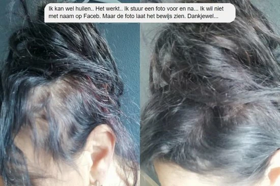 Beste deal π IMPERIO Premium Haarvezels Donkerbruin - Kaalheid Mannen - Alopecia Vrouwen - 100% Onzichtbaar π 12 Beste deal π IMPERIO Premium Haarvezels Donkerbruin - Kaalheid Mannen - Alopecia Vrouwen - 100% Onzichtbaar π - Afbeelding 10