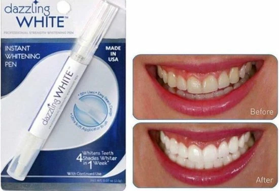 Kopen β€οΈ Dazzling White White Whitening Pen - Tandenbleek Pen - Tandenbleekpen - Witte Tanden - Whitening Pen - Tanden Bleken π 3 Kopen β€οΈ Dazzling White White Whitening Pen - Tandenbleek Pen - Tandenbleekpen - Witte Tanden - Whitening Pen - Tanden Bleken π