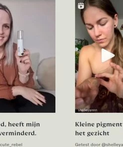 Beste recensies van 😀 Skinlight Huidbleekcreme - 60ml - Alle Huidtypes - Maakt De Huid Tot 3 Tinten Lichter 🧨 -Oral-B Shop 550x438