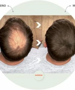 Beste deal π IMPERIO Premium Haarvezels Donkerbruin - Kaalheid Mannen - Alopecia Vrouwen - 100% Onzichtbaar π 32 Beste deal π IMPERIO Premium Haarvezels Donkerbruin - Kaalheid Mannen - Alopecia Vrouwen - 100% Onzichtbaar π -Oral-B Shop 550x463 1
