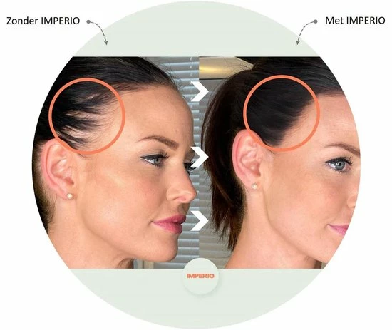 Beste deal π IMPERIO Premium Haarvezels Donkerbruin - Kaalheid Mannen - Alopecia Vrouwen - 100% Onzichtbaar π 10 Beste deal π IMPERIO Premium Haarvezels Donkerbruin - Kaalheid Mannen - Alopecia Vrouwen - 100% Onzichtbaar π - Afbeelding 8