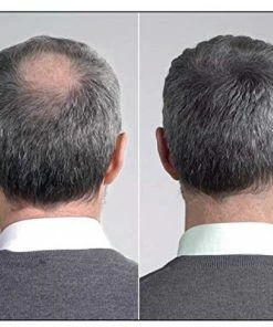 Beste deal π IMPERIO Premium Haarvezels Donkerbruin - Kaalheid Mannen - Alopecia Vrouwen - 100% Onzichtbaar π 35 Beste deal π IMPERIO Premium Haarvezels Donkerbruin - Kaalheid Mannen - Alopecia Vrouwen - 100% Onzichtbaar π -Oral-B Shop 550x465 1