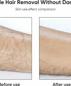 Coupon π Merkloos Crystal Hair Remover - Kristalpad - Ontharing -Pijnloos - Haarverwijderaar - Bekend Van TikTok - Vaderdag π€© 9 Coupon π Merkloos Crystal Hair Remover - Kristalpad - Ontharing -Pijnloos - Haarverwijderaar - Bekend Van TikTok - Vaderdag π€© -Oral-B Shop 550x480