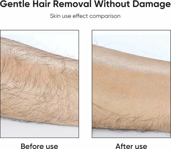 Coupon π Merkloos Crystal Hair Remover - Kristalpad - Ontharing -Pijnloos - Haarverwijderaar - Bekend Van TikTok - Vaderdag π€© 6 Coupon π Merkloos Crystal Hair Remover - Kristalpad - Ontharing -Pijnloos - Haarverwijderaar - Bekend Van TikTok - Vaderdag π€© - Afbeelding 4