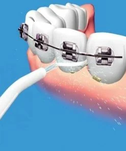 Nieuw 🎉 Merkloos Waterflosser Smile - Tandenstoker Alternatief 💯 -Oral-B Shop 550x496 3