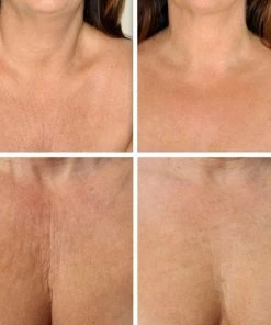 Beste Pirce π Simia™ Anti Rimpel Beauty Pads - Decolleté Large T Shape Set (2 Stuks) - Herbruikbaar Anti Aging Siliconen Pad Tegen Lijntjes En Slaaprimpels π 11 Beste Pirce π Simia™ Anti Rimpel Beauty Pads - Decolleté Large T Shape Set (2 Stuks) - Herbruikbaar Anti Aging Siliconen Pad Tegen Lijntjes En Slaaprimpels π -Oral-B Shop 550x522