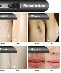 Promo π Shinon Sportsman 4 In 1 Oplaadbare, Multifunctionele Neus- En Oortrimmer - Neushaartrimmer - Baardtrimmer - Wenkbrauwtrimmer - Scheerapparaat - Mannen π 16 Promo π Shinon Sportsman 4 In 1 Oplaadbare, Multifunctionele Neus- En Oortrimmer - Neushaartrimmer - Baardtrimmer - Wenkbrauwtrimmer - Scheerapparaat - Mannen π -Oral-B Shop 550x550 103