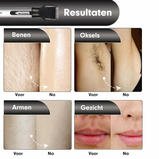 Promo π Shinon Sportsman 4 In 1 Oplaadbare, Multifunctionele Neus- En Oortrimmer - Neushaartrimmer - Baardtrimmer - Wenkbrauwtrimmer - Scheerapparaat - Mannen π 8 Promo π Shinon Sportsman 4 In 1 Oplaadbare, Multifunctionele Neus- En Oortrimmer - Neushaartrimmer - Baardtrimmer - Wenkbrauwtrimmer - Scheerapparaat - Mannen π - Afbeelding 6