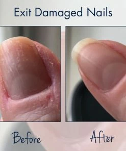 Beste deal 𧨠Herome 3 In 1 Manicure Nagelverzorging Set (Nail Essentials Set Na Kunstnagels Of Medicijngebruik (Roze)) - Nagelriemolie, Nagelriemcrème En Nagelverharder – Voor Mooie En Gezonde Nagels - Full-Size π 23 Beste deal 𧨠Herome 3 In 1 Manicure Nagelverzorging Set (Nail Essentials Set Na Kunstnagels Of Medicijngebruik (Roze)) - Nagelriemolie, Nagelriemcrème En Nagelverharder – Voor Mooie En Gezonde Nagels - Full-Size π -Oral-B Shop 550x550 17