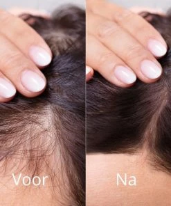 Beste deal 👍 Eelhoe Gember Haargroei Serum - Cyber Monday Week 1 + 1 GRATIS - Gember Haar Spray Voor Haargoei - Vollere Bos Haren - Anti Kaalheid - Haar Wordt Dikker - Ginger Hairspray - Ga Dunner Wordend Haar Tegen - Betere Baardgroei 🔔 -Oral-B Shop 550x550 402