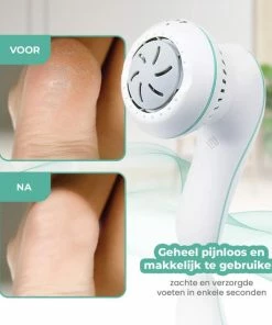 Korting 🤩 Merkloos Elektrische Eeltverwijderaar - Voetvijl - Pedicureset - Professioneel ❤️ 14 Korting 🤩 Merkloos Elektrische Eeltverwijderaar - Voetvijl - Pedicureset - Professioneel ❤️ -Oral-B Shop 550x550 568