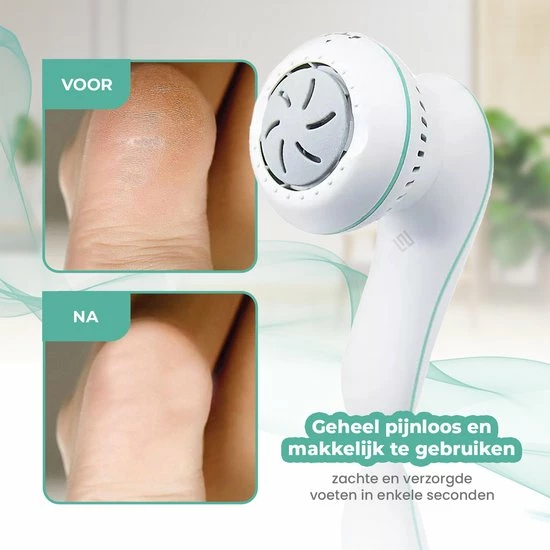 Korting 🤩 Merkloos Elektrische Eeltverwijderaar - Voetvijl - Pedicureset - Professioneel ❤️ 5 Korting 🤩 Merkloos Elektrische Eeltverwijderaar - Voetvijl - Pedicureset - Professioneel ❤️ - Afbeelding 3