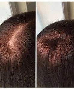 Beste deal π IMPERIO Premium Haarvezels Donkerbruin - Kaalheid Mannen - Alopecia Vrouwen - 100% Onzichtbaar π 43 Beste deal π IMPERIO Premium Haarvezels Donkerbruin - Kaalheid Mannen - Alopecia Vrouwen - 100% Onzichtbaar π -Oral-B Shop 550x550 66