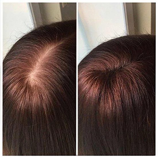 Beste deal π IMPERIO Premium Haarvezels Donkerbruin - Kaalheid Mannen - Alopecia Vrouwen - 100% Onzichtbaar π 22 Beste deal π IMPERIO Premium Haarvezels Donkerbruin - Kaalheid Mannen - Alopecia Vrouwen - 100% Onzichtbaar π - Afbeelding 20