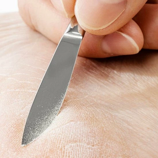 Beste recensies van ???? MEDLUXY - Pedicure Eeltschraper - Scalpel - 15.5 Cm - RVS - (eeltmes, Callus Eelt Verwijderaar, Eeltschaaf, Scalpel) ???? 4 Beste recensies van ???? MEDLUXY - Pedicure Eeltschraper - Scalpel - 15.5 Cm - RVS - (eeltmes, Callus Eelt Verwijderaar, Eeltschaaf, Scalpel) ???? - Afbeelding 2