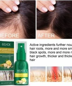 Beste deal 👍 Eelhoe Gember Haargroei Serum - Cyber Monday Week 1 + 1 GRATIS - Gember Haar Spray Voor Haargoei - Vollere Bos Haren - Anti Kaalheid - Haar Wordt Dikker - Ginger Hairspray - Ga Dunner Wordend Haar Tegen - Betere Baardgroei 🔔 -Oral-B Shop 550x553 3